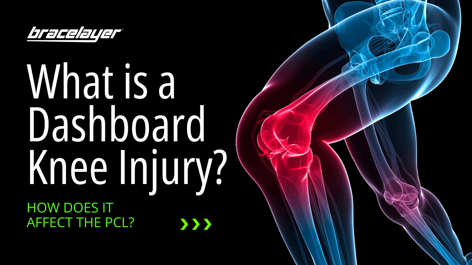 What is a Dashboard Knee Injury and it's Effect on the PCL? Dashboard Injury, Dashboard Knee, football injury, Knee Injury, PCL, PCL Healing Time, PCL Symptoms, soccer injury Bracelayer® USA | Knee Compression Gear