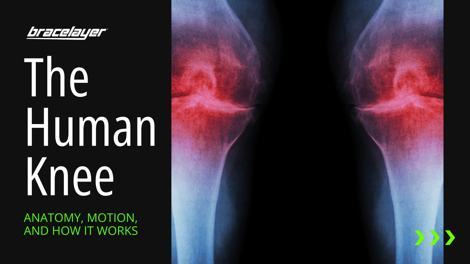 The Human Knee: anatomy, motion, and how it works cartilage, the knee anatomy, Femur, Fibia, Knee Injury, Knee Ligament, meniscus, Patella, PCL, Tibia. Graphic by Bracelayer® USA | Knee Compression Gear